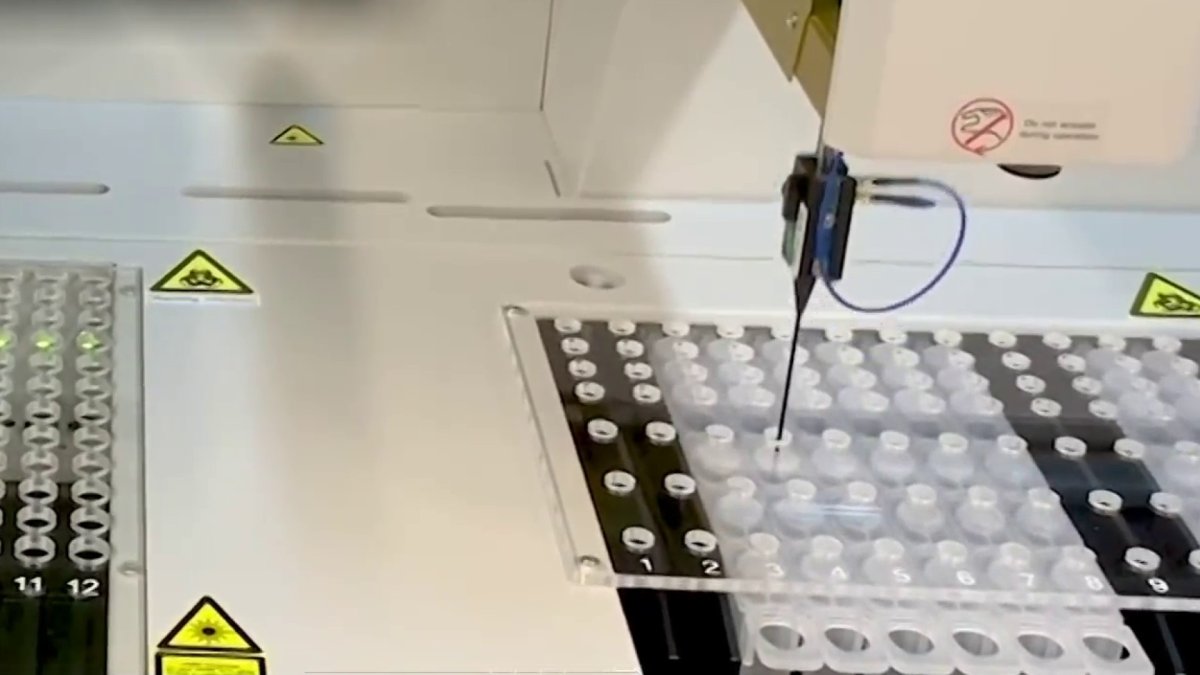 Boston Heart Diagnostics Develops Antibody Test for Coronavirus NBC