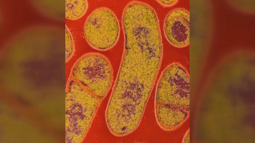 5-25-17-parasite-botulism
