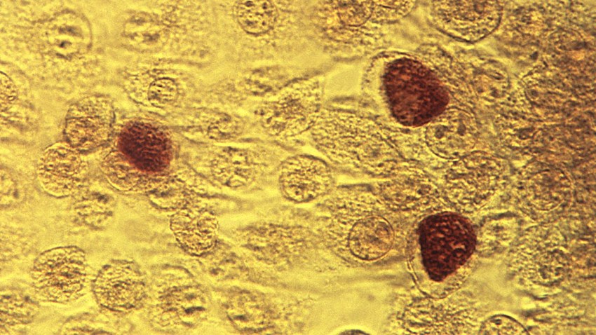 STD Cases