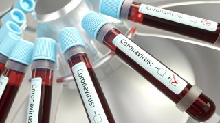 Coronaviruses research, conceptual illustration. Vials of blood in a centrifuge being tested for coronavirus infection.