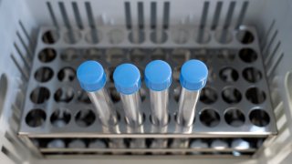 File photo of coronavirus tests.