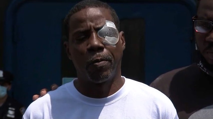 Man with eye covering from injury