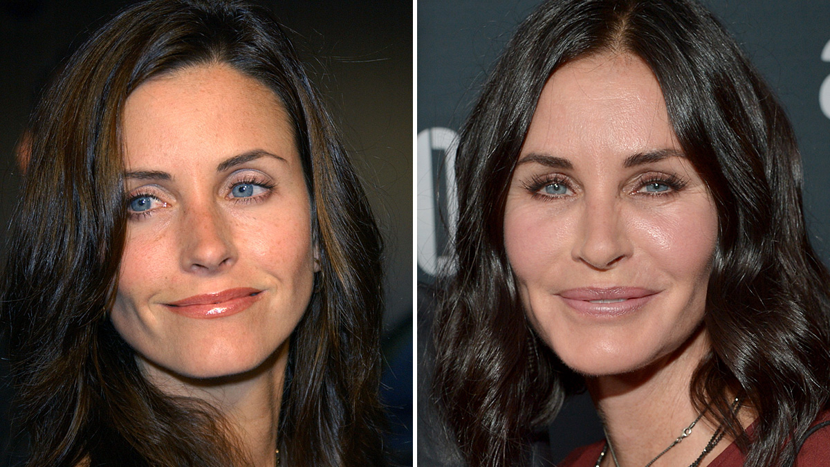 Courteney Cox ‘Regrets’ Plastic Surgery Procedures NBC Boston