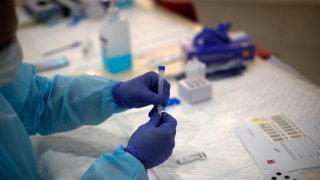 A medical worker conducts a rapid diagnostic test (RPT) for coronavirus.