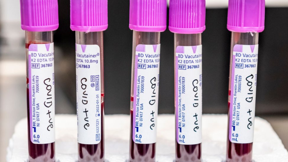 Nahezu 4000 Menschen, die vollständig geimpft sind, wurden positiv auf das Coronavirus getestet, so neue Daten des Massachusetts Department of Public Health