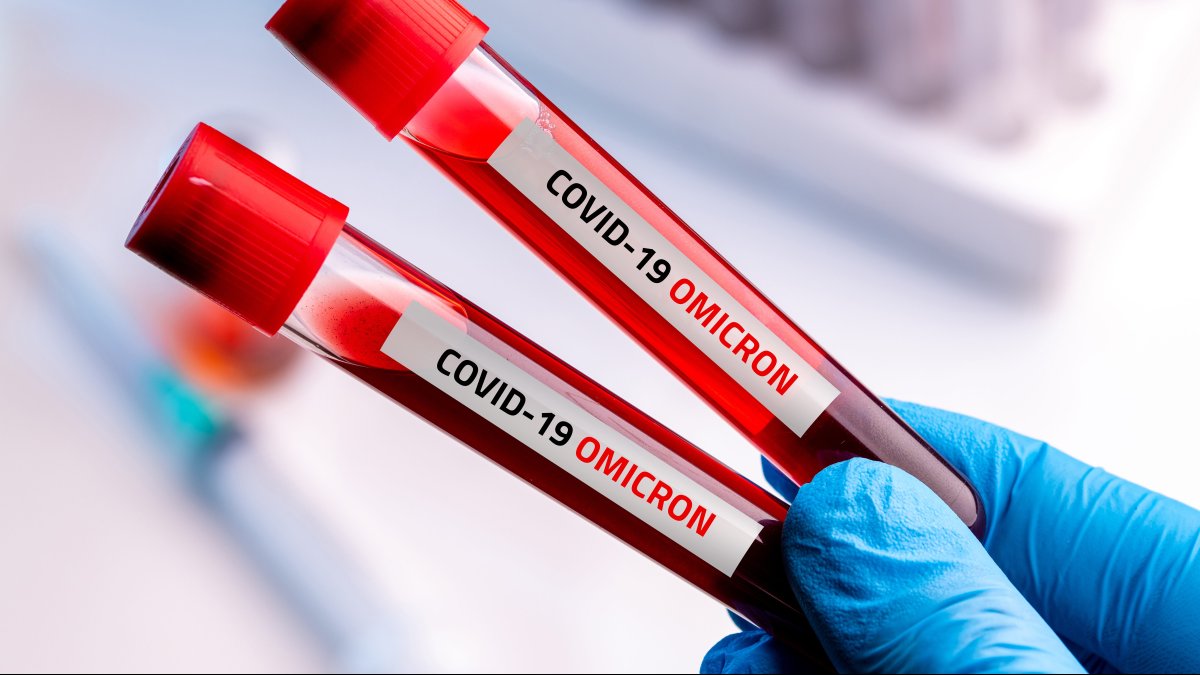 Is Omicron in the US Yet? Here’s What Boston Doctors Say NBC Boston