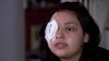 Man Arrested Weeks After Brutal Attack on Fast Food Worker Led to Her Losing Eye