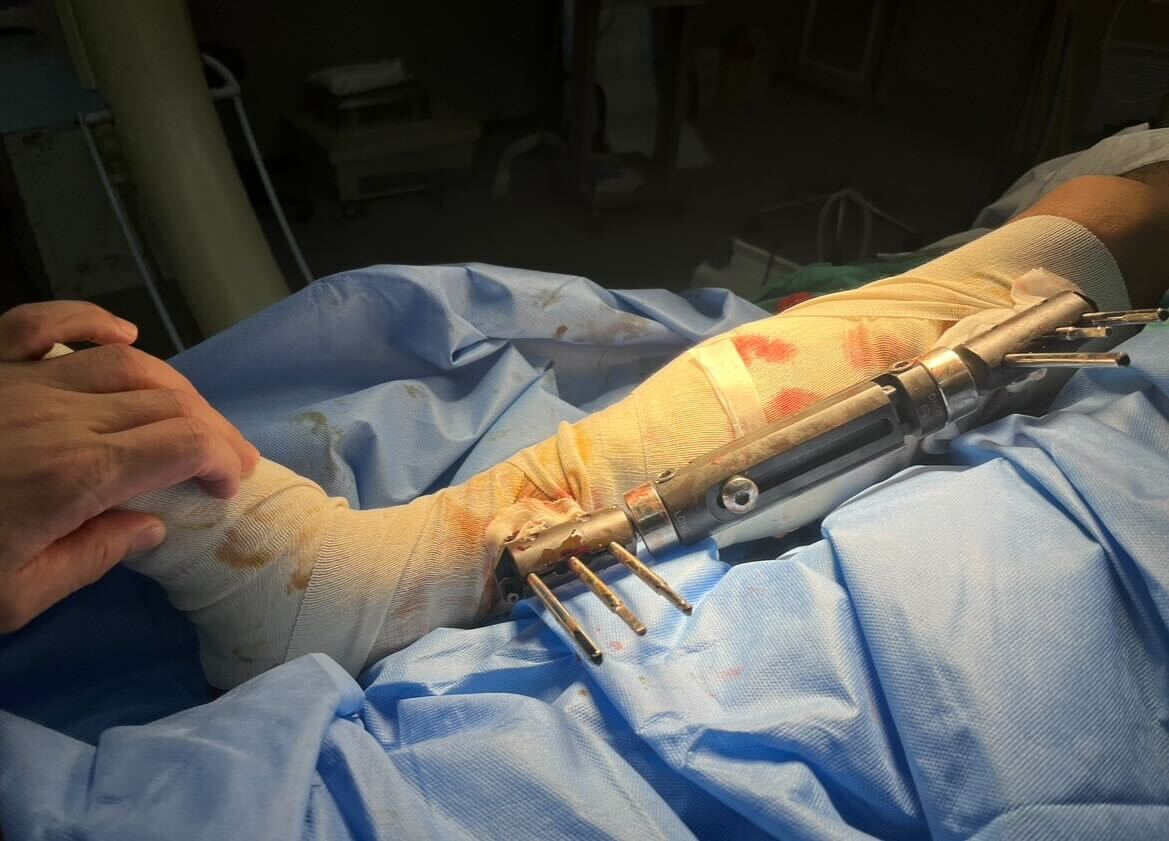 North Texas orthopedic surgeon, Khawaja Ikram, served patients in Gaza from Jan. 26 to Feb. 8. (Photo courtesy Dr. Khawaja Ikram)