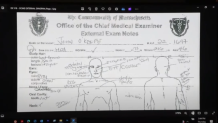 A copy of notes from the medical exam done on the body of John O'Keefe, shown Thursday, Jun 20, 2024, in the Karen Read murder trial in Norfolk Superior Court.