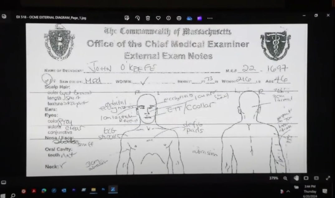 A copy of notes from the medical exam done on the body of John O'Keefe, shown Thursday, Jun 20, 2024, in the Karen Read murder trial in Norfolk Superior Court.
