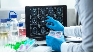 Neurology research, conceptual image. Scientist viewing a patient's brain scan
