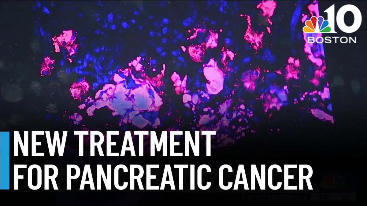 New Pancreatic Cancer Treatment