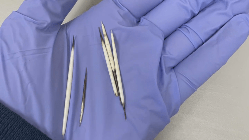 Porcupine quills found in a dead raccoon on Cape Cod.