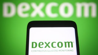 The Dexcom logo is seen on a smartphone screen and in the background.