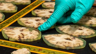 Four-millimeter slices of brain are preserved and embedded in a gel called agarose at Harborview Medical Center in Seattle