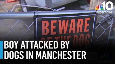 8-year-old boy seriously hurt in Manchester, NH dog attack
