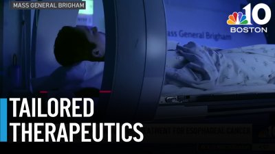 MGB doctors working on innovative esophageal cancer treatment