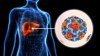 Hepatitis A infection warning for recent diners at Cape Cod restaurant