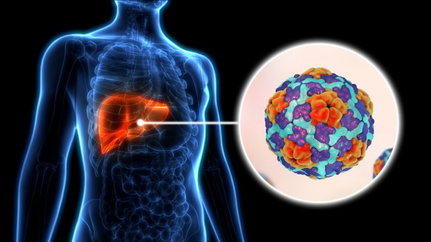 An illustration showing a hepatitis A molecule and a person's liver.