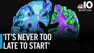 Boston researchers say brain score is key predictor of stroke in women