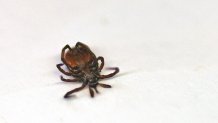 A deer tick after being pulled from a Massachusetts woman's neck. Left unchecked, deer ticks can transmit Lyme disease to humans.
