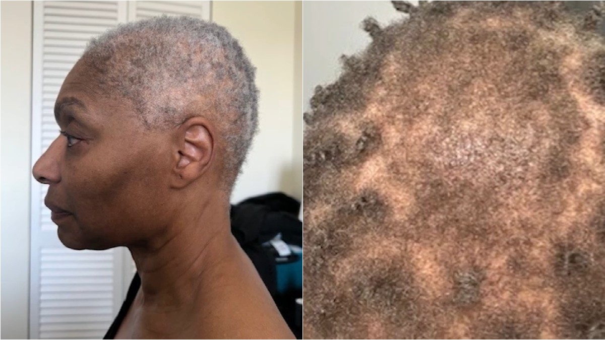 Actress sues theater company, alleging racial discrimination led to hair loss