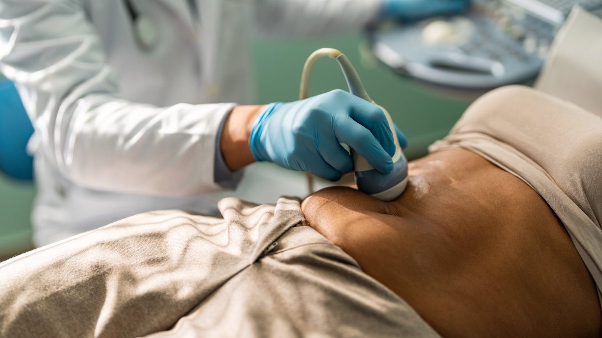 AI finds signs of pancreatic cancer before tumors develop