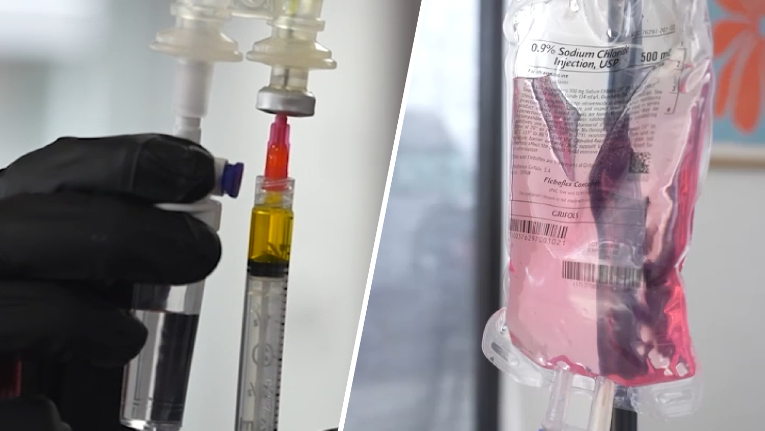 IV therapy, explained: it’s not just for hangovers anymore – NBC Boston