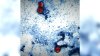 86 people have been hospitalized with foodborne parasite spreading across the U.S., CDC says
