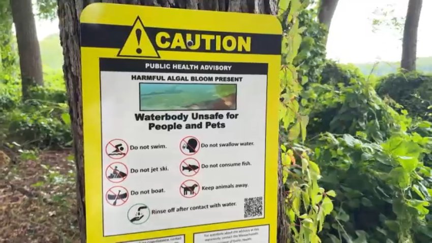 A warning sign posted at a park along the Charles River noting that the water is unsafe for people and pets.