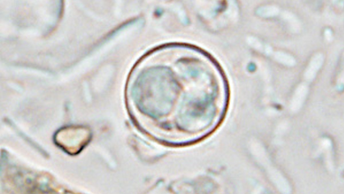 Mass. cyclospora illnesses jump as health officials find links to national outbreak