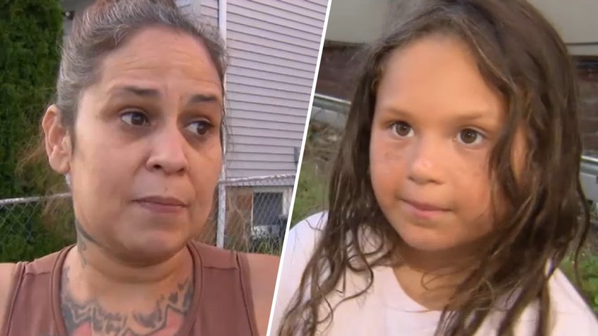Zena Bottom, left, and Janessa Williams, right, were injured in fox attacks hours apart in their Worcester neighborhood.