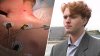 Man recalls Allston knife attack that left him and 2 friends injured